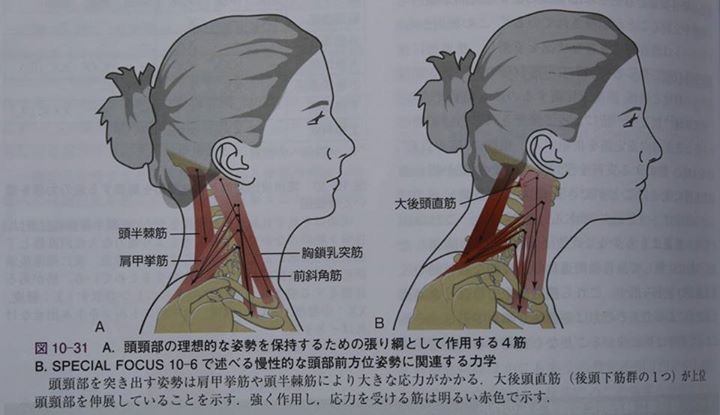 頭部前方変位